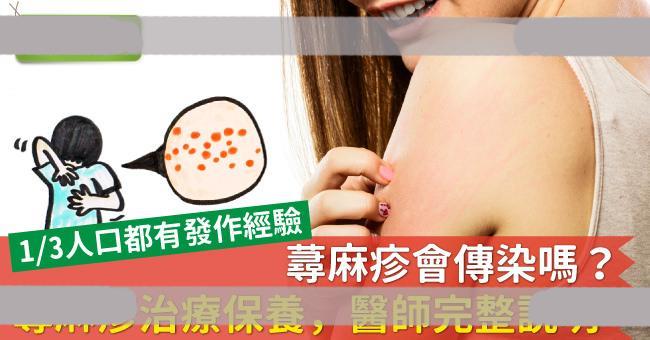 荨麻疹让全身红肿痒?荨麻疹治疗保养,医师完整说明 荨麻疹让全身红肿痒?荨麻疹治疗保养,医师完整说明